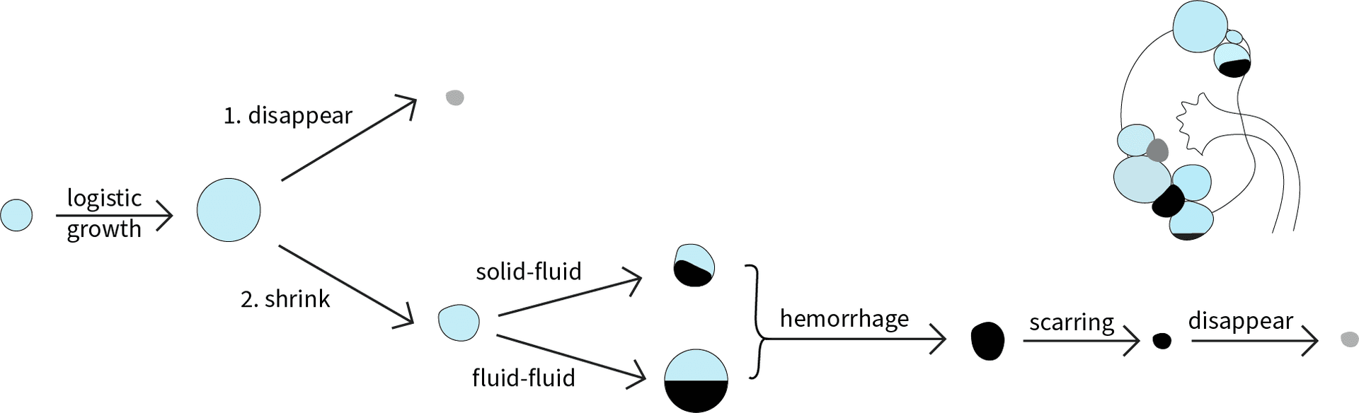 Figure for Natural History of Simple and Complex Cysts in ADPKD on MRI